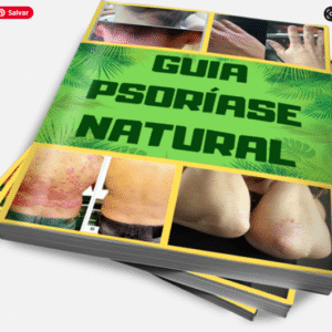 O Guia Psoríase Natural